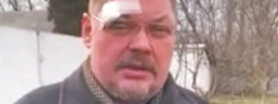 «Сліди Христової любові»: На Чернігівщині прихильники УПЦ МП побили священника ПЦУ