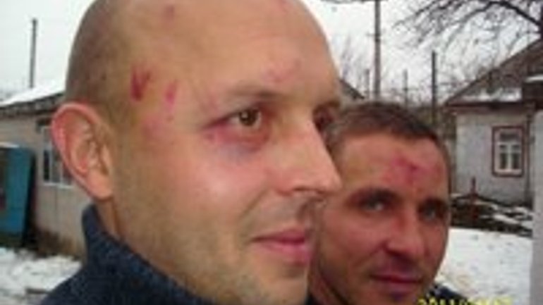 В Украине неизвестные напали на христианский ребцентр - фото 1