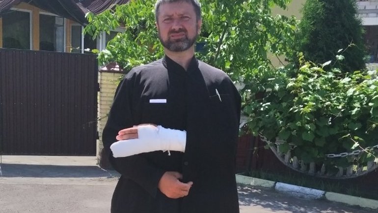 На Волині пенсіонер зламав пальці священнику УПЦ МП - фото 1